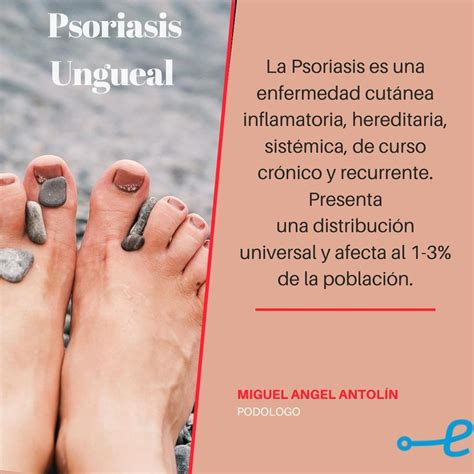 La Psoriasis Ungueal Espasana