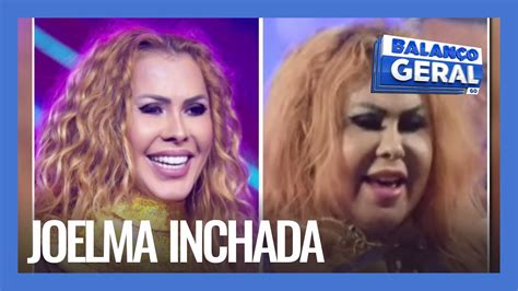 JOELMA INCHADA APARÊNCIA ESTRANHA É UMA SEQUELA DA COVID 19 YouTube