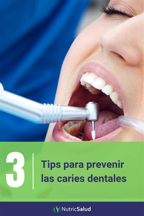 Todo Sobre Caries Causas Tratamientos C Mo Prevenir Y Eliminar Las