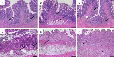 Histomorphology Of Colon Tissue In DSS Induced Colitis In C57BL 6