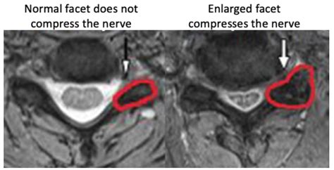 Cervical MRI Anatomy