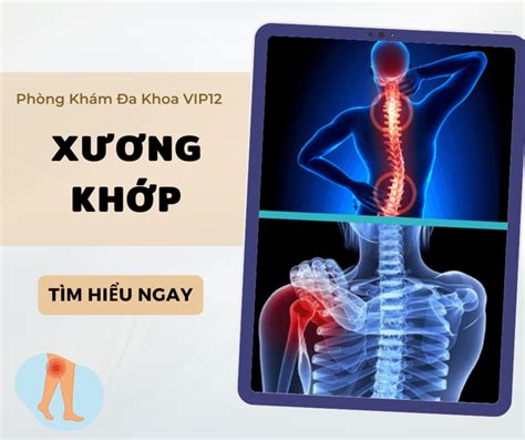 Bệnh lý cơ xương khớp thường gặp CÔNG TY CỔ PHẦN Y TẾ VIP12