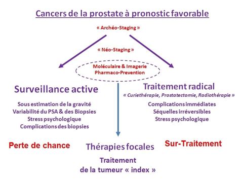 Les Traitements Focaux Pour Guérir Le Cancer De La Prostate Anamacap