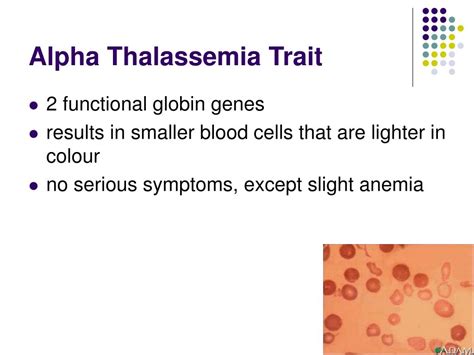 Ppt Thalassemia And Treatment Powerpoint Presentation Free Download