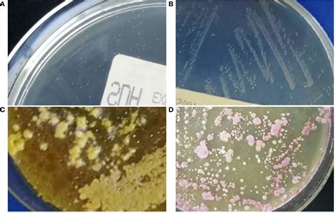 Frontiers Clinical Data Analysis Of 86 Patients With Invasive Infections Caused By Malassezia