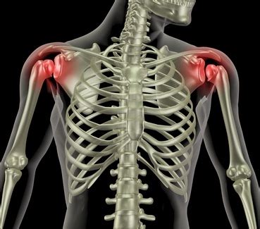 Dislocated Shoulder | Louisville Orthopedic Surgeon | Sports Medicine