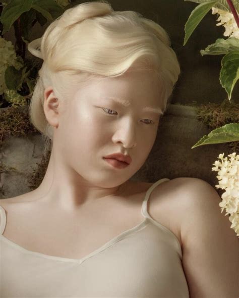 Albino Model