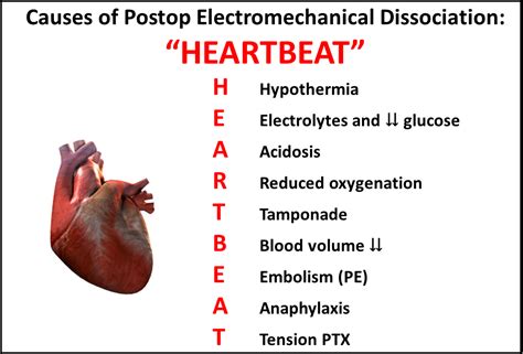 Mnemonics For Cardiothoracic Surgery Ctsnet