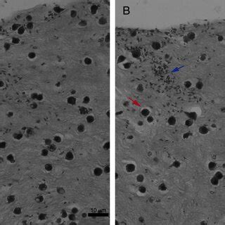 Macrophage Leishmania D Interaction Vizualization By Confocal