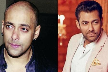 Salman Khan Hair Transplantation | Salman Hair Transplant Cost In India ...