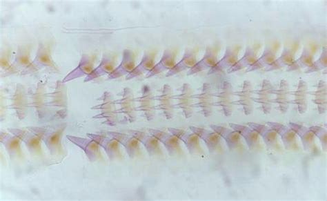 Mollusc Radulae from microscope slides at the Booth Museum, Brighton