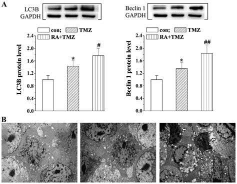 All‑trans Retinoic Acid Enhances Temozolomide‑induced Autophagy In