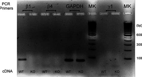 DiBAC4 3 Hits A Sweet Spot For The Activation Of Arterial Large