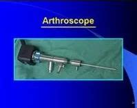 Arthroscopy Surgery Service Medical Surgery Services Specialized