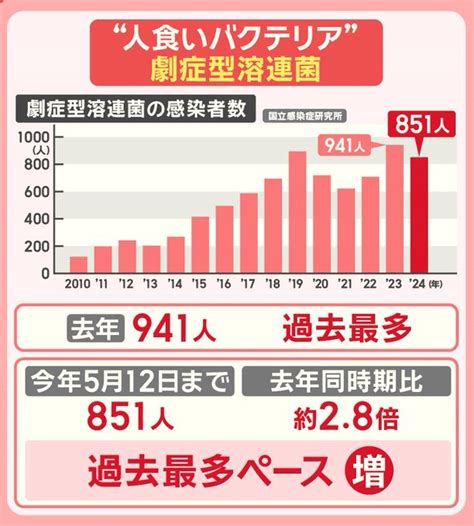 “致死率3割”『劇症型溶連菌』新たな変異株「m1uk」急拡大 治療法と予防法を解説！