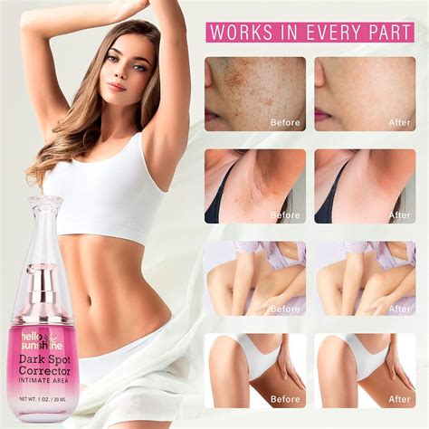 Intimate Area Dark Spot Corrector Cream Dark Spot Corrector For Face Body Bikini And