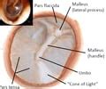 Pars Flaccida Of Tympanic Membrane Hot Sex Picture