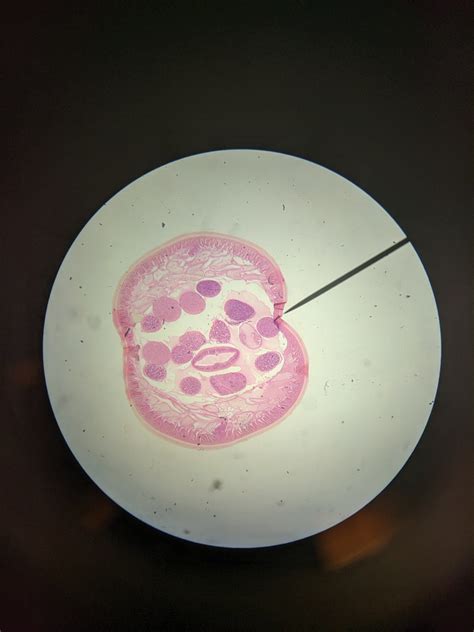 Ascaris Male Diagram Quizlet