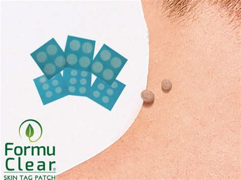 Пластырь Formu Clear от папиллом и бородавок, цена 261 грн — Prom.ua ...