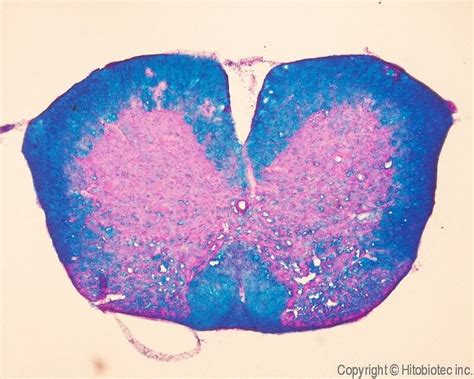 What Is The Luxol Fast Blue Stain — Brain Stuff