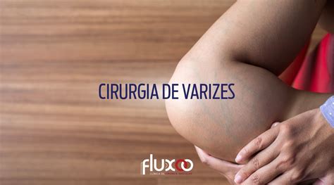 Tratamento De Varizes 2 Fluxo Clínica De Cirurgia Vascular