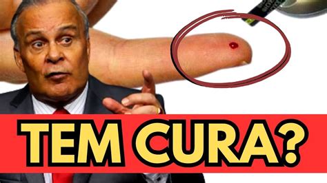 Existe Cura Para Essa Doen A Dr Lair Ribeiro Youtube