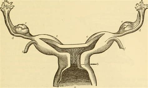 Truths and Myths About Causes of Miscarriage