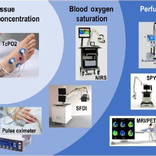 A Schematic Illustration Of The Oxygen Sensing SMART Bandage B