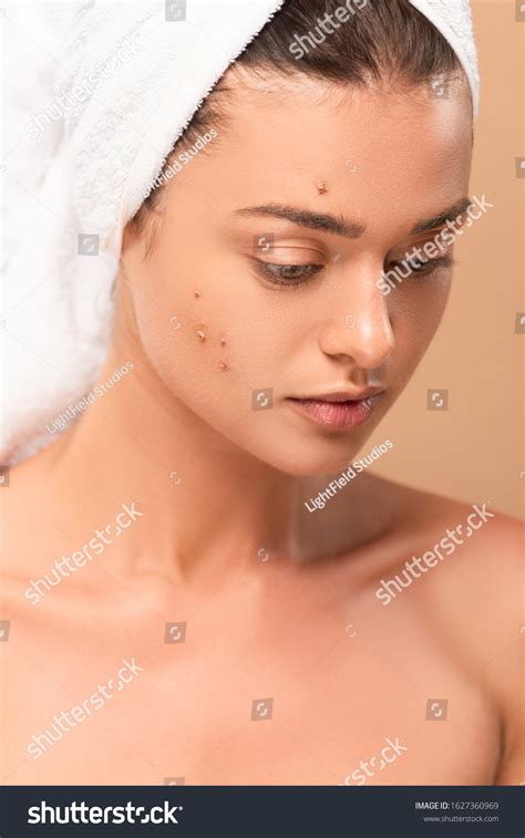Naked Girl Pimples On Face Isolated Stock Photo Edit Now 1627360969