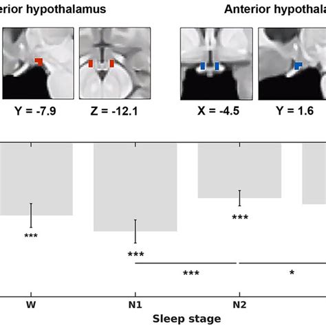 Locations Of Hypothalamic Seed Regions Of Interest ROIs And