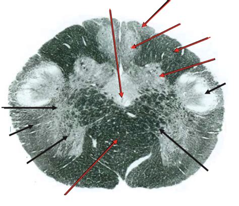 Neuro Quiz Caudal Medulla Diagram Quizlet