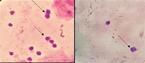 Trichomonas Vaginalis Was Detected Microscopically In The Vaginal Download Scientific Diagram