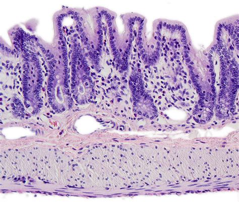 Órganos Animales Sistema Digestivo Intestino Grueso Atlas De