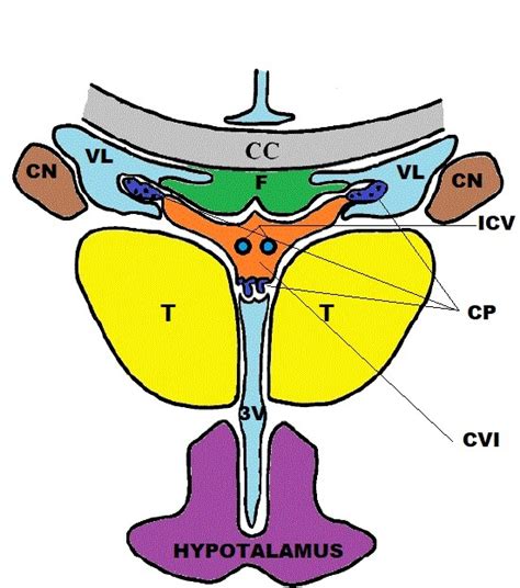 Cavum Veli Interpositi StatPearls NCBI Bookshelf