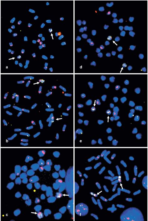 Figure 1 From Mapping Of Rrna Gene Loci In The Mice Mus Musculus Molossinus Japan And Mus