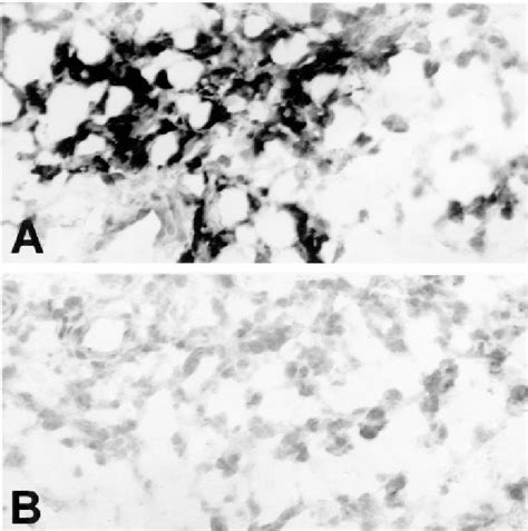 In Situ Hybridization Analysis Of Expression Of Adam8 In The Synovial