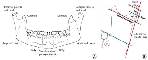 Condylar Process Of Mandible