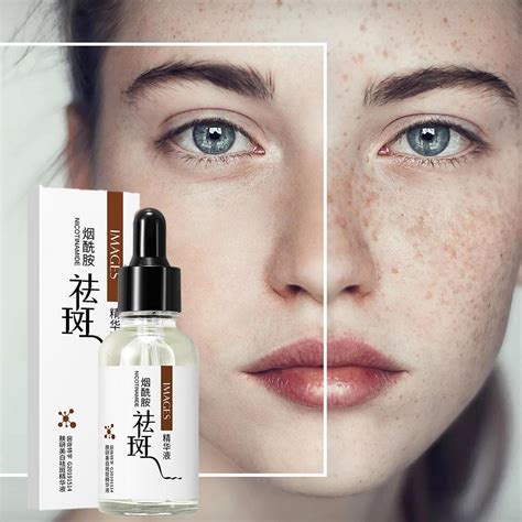 Whitening Freckle Niacinamide Serum Jeragat Remove Melasma Dark Spots