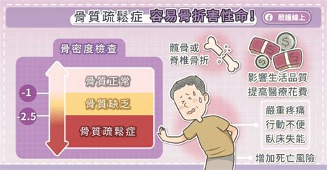 骨質疏鬆症難發覺，避開危險因子、留意身體警訊！ Pansci 泛科學