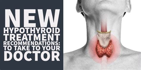 Updated Hypothyroid Treatment Guidelines To Take To Your Doctor