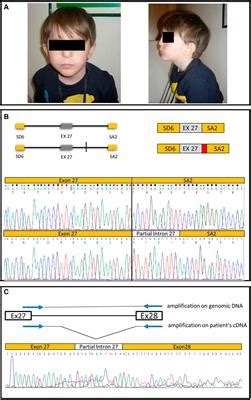 Frontiers Case Report Functional Characterization Of A Novel CHD7