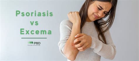 The Difference Between Psoriasis And Eczema Pine Belt Dermatology