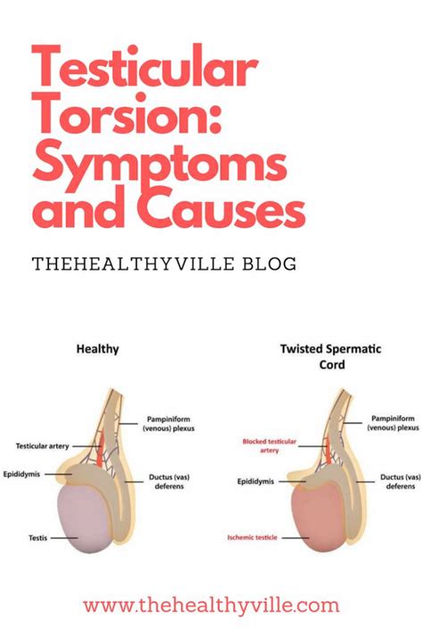 Testicular Pain Facts About Symptoms Causes Treatment Sexiz Pix