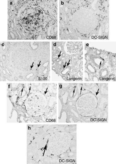 Compartment Specific Expression Of Dendritic Cell Markers In Human