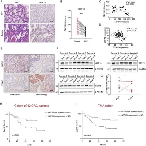 Figure S Gdf Expression Is Higher In Colorectal Cancer Samples