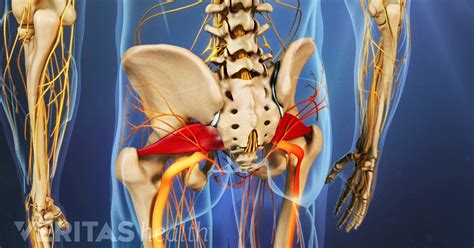 Piriformis Syndrome Video