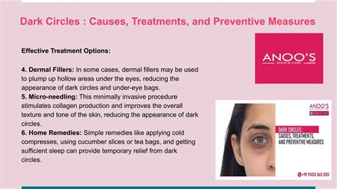 Ppt Dark Circles In Men Causes Treatments And Preventive Measures Powerpoint Presentation