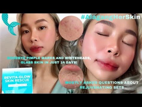 HerSkin Revita Glow Skin Rescue Kit By Kath Melendez Answering