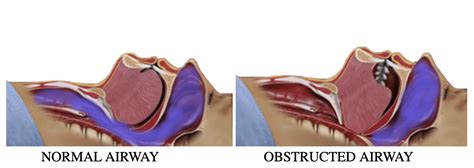 Airways Anatomy Anatomy Diagram Book