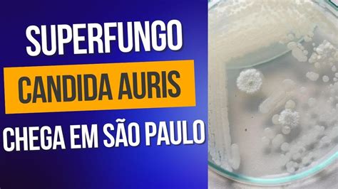 São Paulo confirma primeiro caso de superfungo Candida auris YouTube